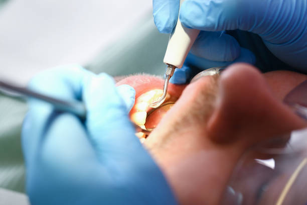Best Dentist for Dental Trauma  in West Middlesex, PA