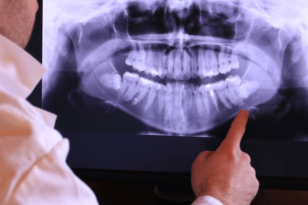 Best Emergency Tooth Extraction  in West Middlesex, PA